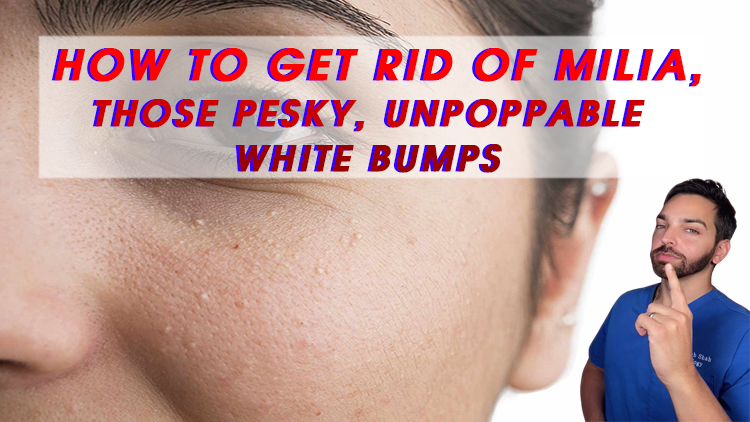How to Get Rid of Milia, Those Pesky, Unpoppable White Bumps
