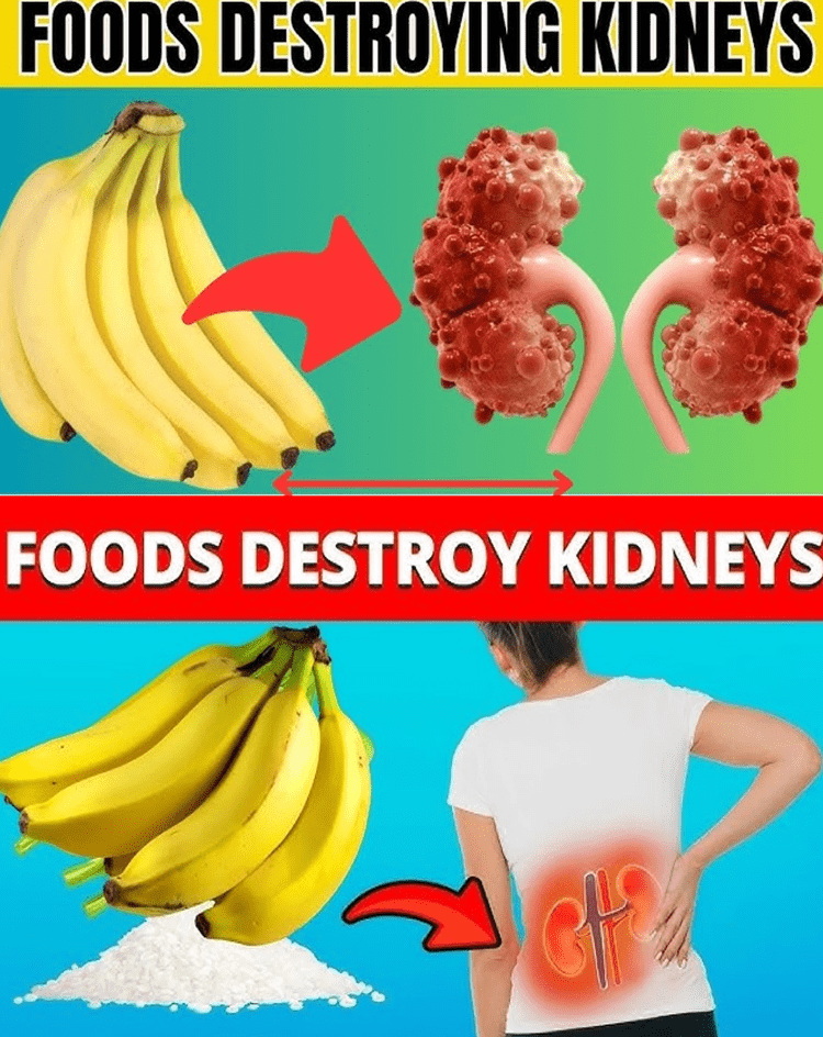 22 Foods You Must Avoid to Heal Your Kidneys